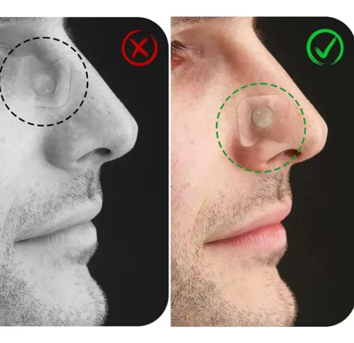 Premium Magnetic Anti-Snore Nose Clip – Breathe Better Tonight